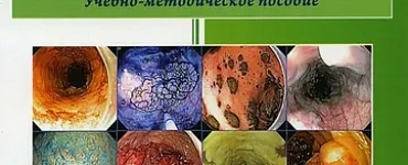 Справочник классификаций, применяемых в эндоскопии желудочно-кишечного тракта